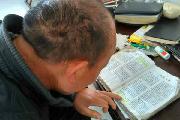 A Leprosy Survivor is reading the Bible.