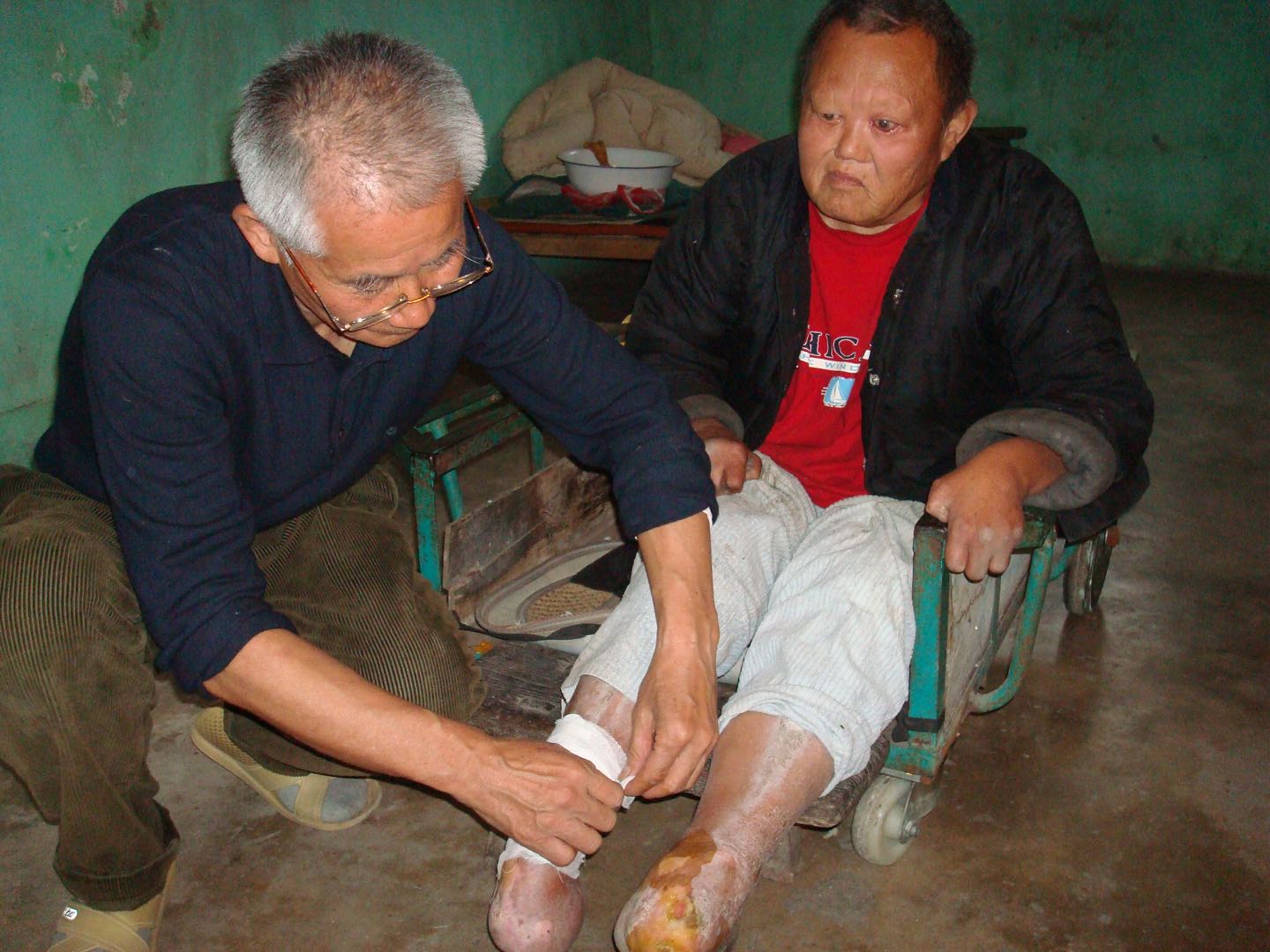 Grandpa Kim patched a leprosy survivor up.